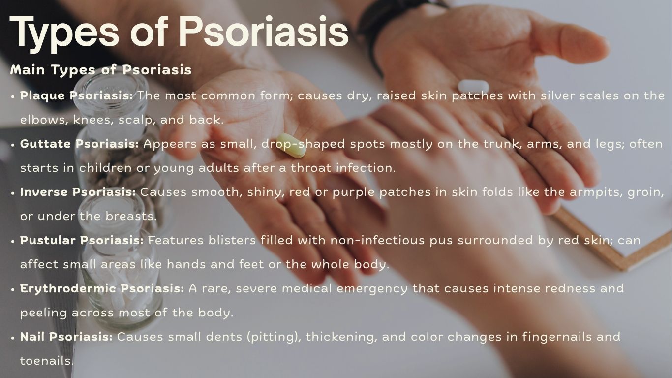 Types of psoriasis